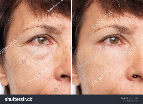 Two Shots Elderly Caucasian Womans Face Stock Photo 2191413989