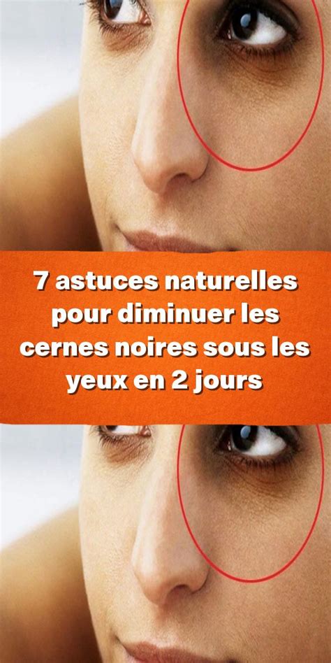 7 Astuces Naturelles Pour Diminuer Les Cernes Noires Sous Les Yeux En 2