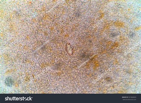 Photos Microscopic Parasite Eggsparasite Stool Exam Stock Photo ...