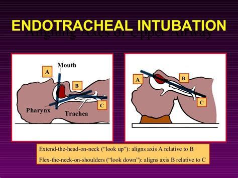 Airway Adjuncts And Management In Acls