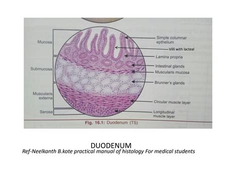 SOLUTION: Histology of small and large intestine - Studypool