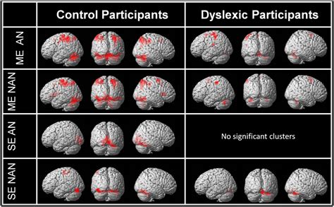 Dyslexic Brain Literacy Solutions