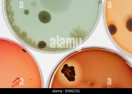 Auswahl Von Mikroben Pilze Bakterienkulturen Auf Agar In Petrischalen