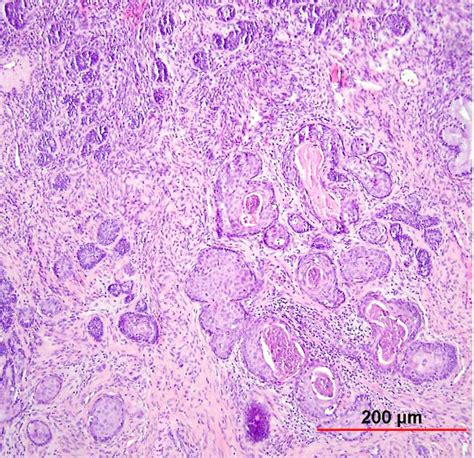 In Shape Of Normal Cervix Cell Under Microscope