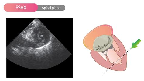 Standard Transthoracic Echocardiogram Complete Imaging Protocol