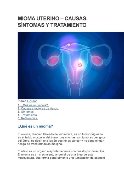 Miomas Mioma Uterino Causas S Ntomas Y Tratamiento Mioma Uterino