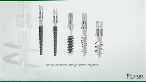 Monoimplant Basalcortical Dental Implant