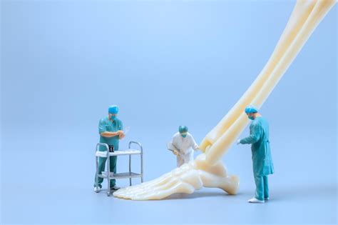 Pessoas Em Miniatura Modelo De Anatomia Da Articula O Do Tornozelo