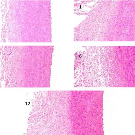 HE Stained Section Of The Cryopreserved Aortic Samples In Different