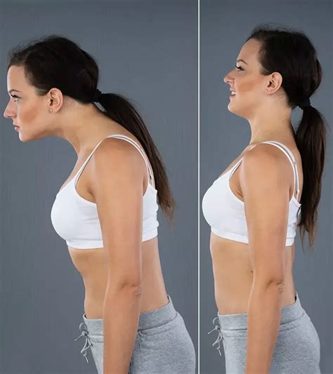 Forward Head Posture Exercises To Reduce Neck Pain Artofit