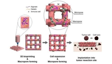 La Bio Impression 3D Pour Traiter Le Cancer Plus Efficacement 3Dnatives