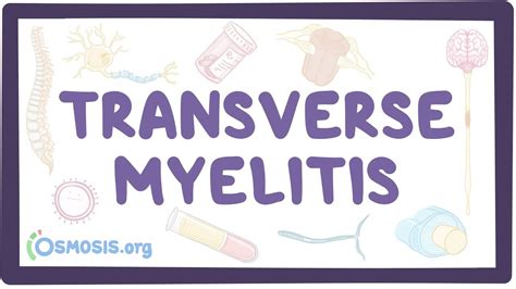 Transverse Myelitis Video Anatomy Definition Osmosis