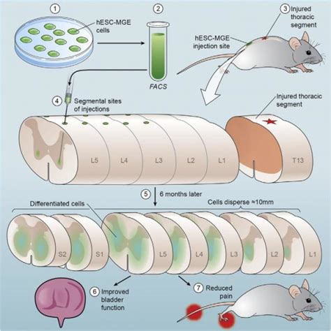 Human Stem Cells Treat Spinal Cord Injury Side Effects In Mice Bioengineer