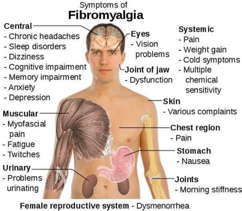 Symptoms Of Fibro Fibromyalgia Causes Fibromyalgia Symptoms Fibromyalgia Cure