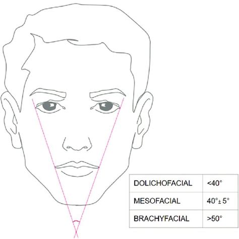 Determination Of The Facial Biotype With The Bjork Jarabak