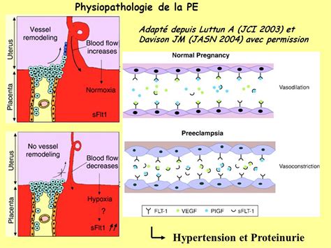 Physiopathologie De L Eclampsie Pdf