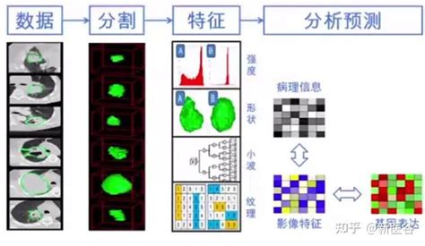 影像时间 浅谈影像组学与人工智能 知乎