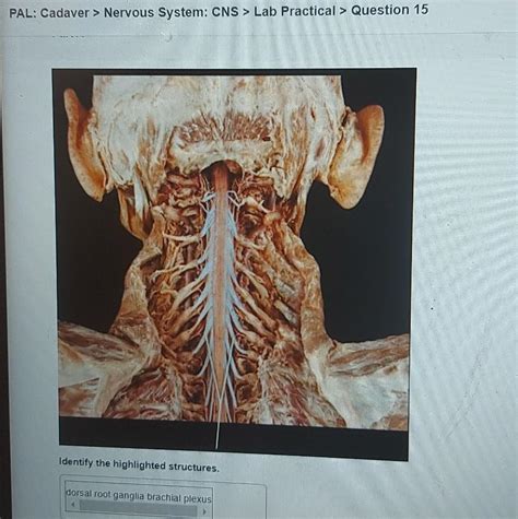 Solved Pal Cadaver Nervous System Cns Lab Practical Chegg