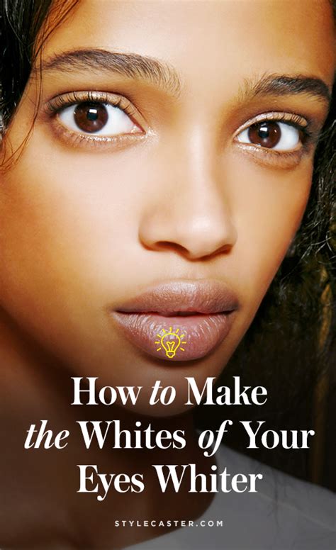 Have Yellow Eyes Heres How To Make Them White Again Whiten Eyes