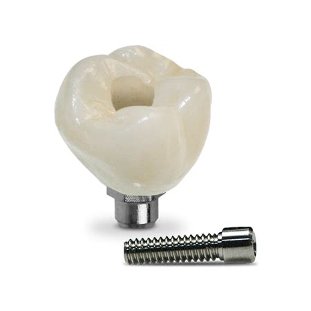 Screw-Retained-Implant-Solution - Atlas Dental