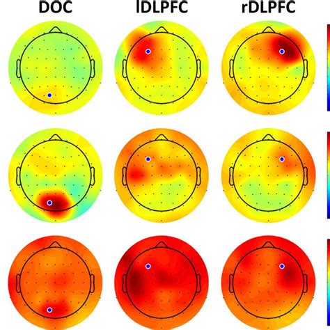 Scalp Distribution Of The Ersp Modulations The Topoplots Show The