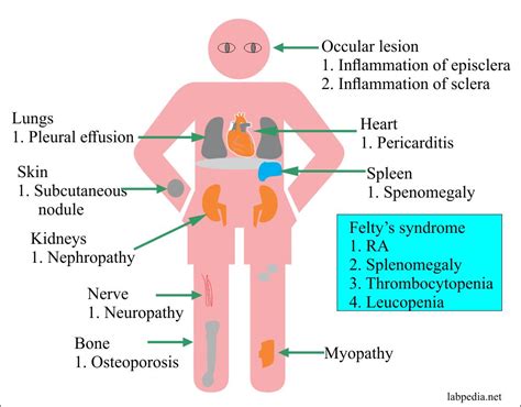 Chapter Autoimmune Diseases Rheumatoid Arthritis Ra Labpedia Net