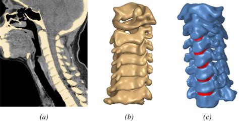 Modelling Methodology For The Cervical Spine A Geometrical Download Scientific Diagram