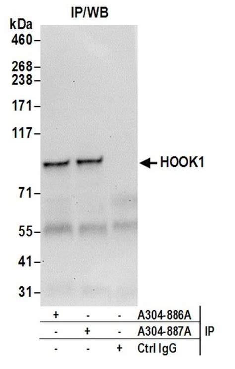 Hook1 Polyclonal Antibody A304 886a