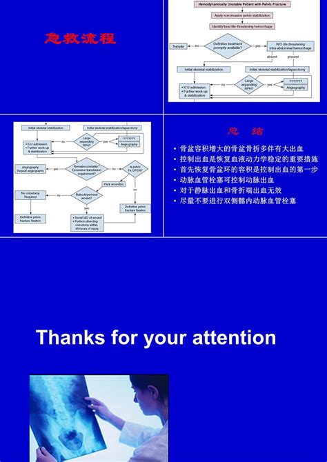 严重骨盆骨折的急救处理ppt模板卡卡办公