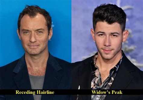 Widows Peak Vs Receding Hairline How To Tell The Difference