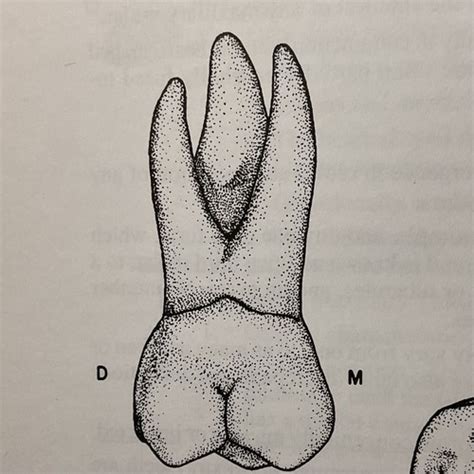 Dental anatomy exam 2 images Flashcards | Quizlet