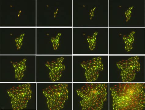 Fission Yeast Cells Dividing Under A Fluorescence Microscope