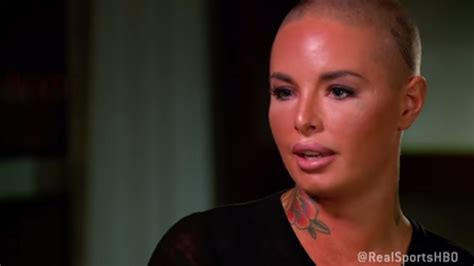 Christy Mack Recovery