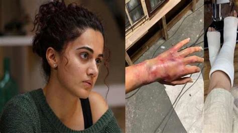 Taapsee Pannu Injured Somewhere On The Set During Shooting Of Game