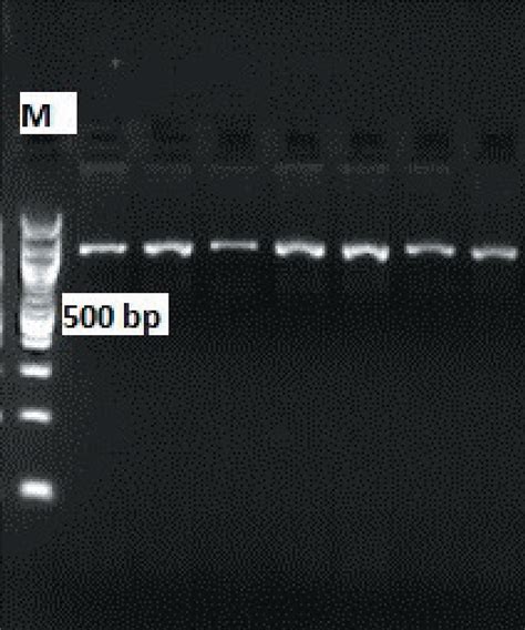 Scielo Brasil Investigation Of Prl Rsai And Haeiii Gene Polymorphisms