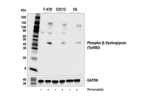 Phospho β Dystroglycan Tyr892 E6T9O Rabbit mAb Cell Signaling