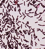 Clostridium Perfringens Gram Stain