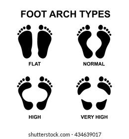 Foot Arch Types Vector Infographics Set Stock Vector (Royalty Free ...