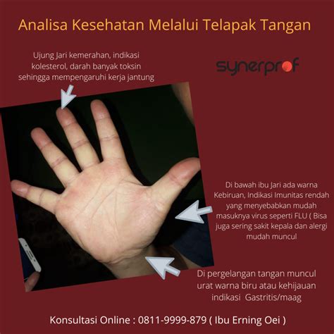 0811 9999 879 Cek Kesehatan Analisa Penyakit Melalui Telapak Tangan Secara Online Wa Call