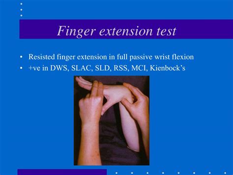 Ppt Examination Of The Wrist Powerpoint Presentation Free Download Id 259339