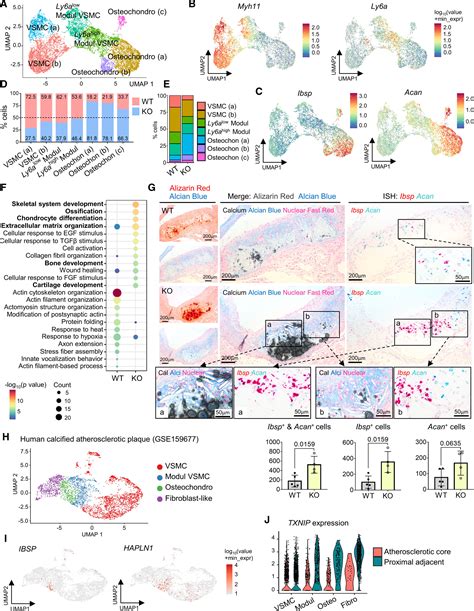 Txnip Suppresses The Osteochondrogenic Switch Of Vascular Smooth Muscle