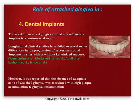 Attached Gingiva And Procedures For Gingival Augmentation Ppt