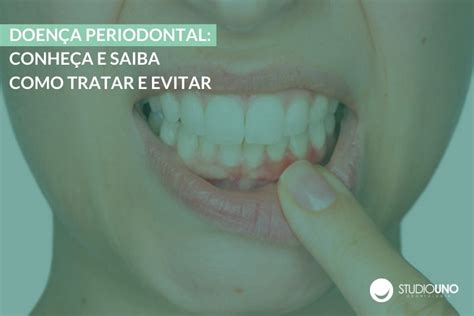 Doen A Periodontal Conhe A E Saiba Como Tratar E Evitar