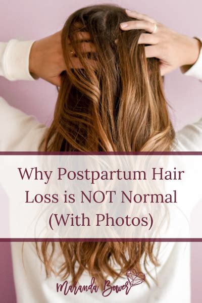 Why Postpartum Hair Loss Is Not Normal With Photos Postpartum