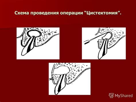 Презентация на тему: "Лекция по хирургической стоматологии на тему ...