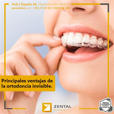 Conoce Las Ventajas De La Ortodoncia Invisible Invisalign Zental