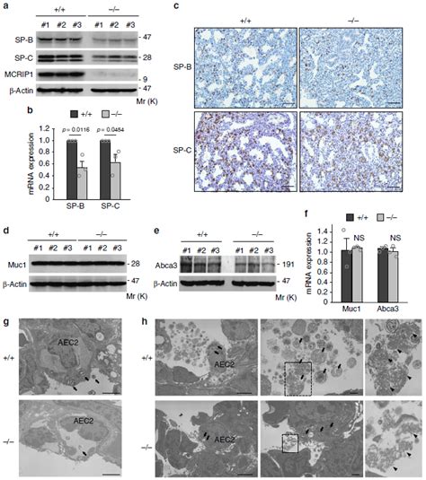 Sftpc Immunohistochemistry Gene Expression Assay Gxd