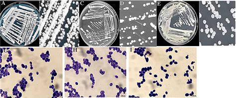 Frontiers Screening And Oenological Property Analysis Of Ethanol