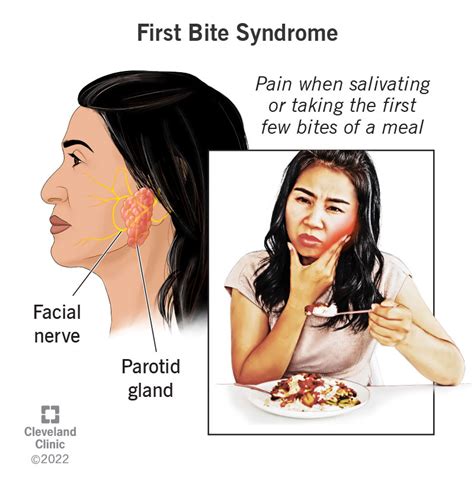 Swollen Parotid Gland On One Side