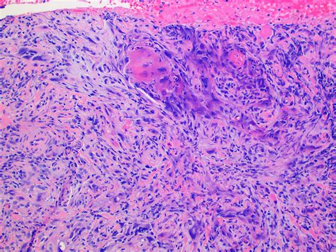 Lips Pathology Outlines Lipstutorial Org